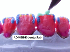 শক্তি প্রাকৃতিক নান্দনিকতা সলিড জিরকোনিয়া মুকুট একক বা একাধিক দাঁতের জন্য উপযুক্ত