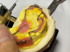 কাস্টমাইজড অর্থোড্যান্টিক যন্ত্রপাতি যা ভালভাবে ধরে রাখা এবং নিয়মিত বৈশিষ্ট্যযুক্ত