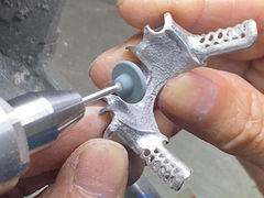 আংশিক দাঁত ভাঁজ