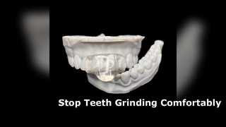 দাঁত নাকাল এবং Bruxism জন্য কাস্টম মিনি নাইট গার্ড