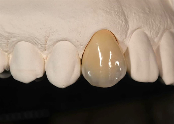 কেনা রং প্রতিরোধের সামনের দাঁত জন্য কঠিন Zirconia মুকুট পিছনের দাঁত online manufacture