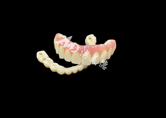 কেনা ইম্পল্যান্ট সমর্থিত প্রোটেটস ব্রিজ online manufacture