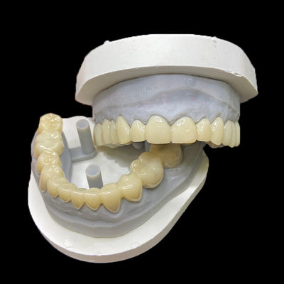 কেনা PMMA Temporary Restorations CAD/CAM PMMA Crowns and Bridges for Provisional Dental Cases online manufacture