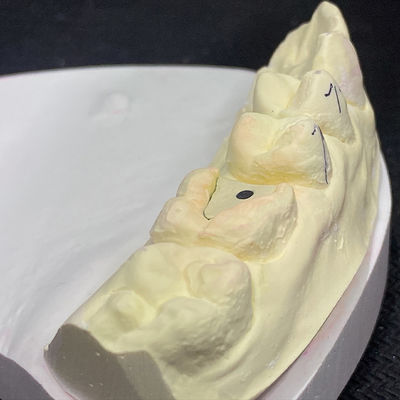 কেনা লক পিঙ্ক পোস্ট কোর টেকনোলজি দিয়ে আপনার পুনরুদ্ধারকে শক্তিশালী করুন online manufacture