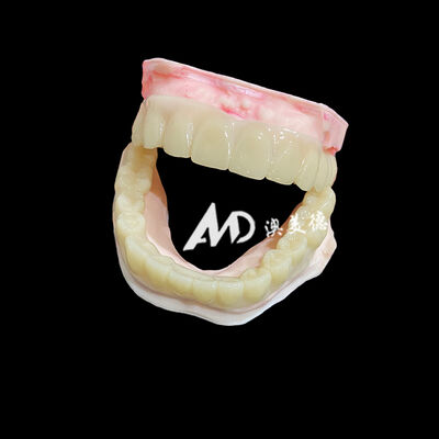 কেনা Lightweight PMMA Temporary Bridges with Hollow Design for Implant Restorations online manufacture