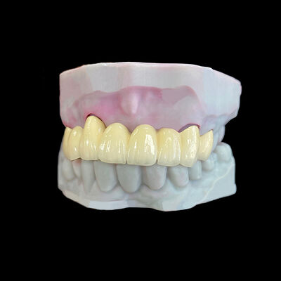 কেনা কো-সিআর ফ্রেম সহ ধাতুতে গলিত পোরসেলান (পিএফএম) মুকুট online manufacture