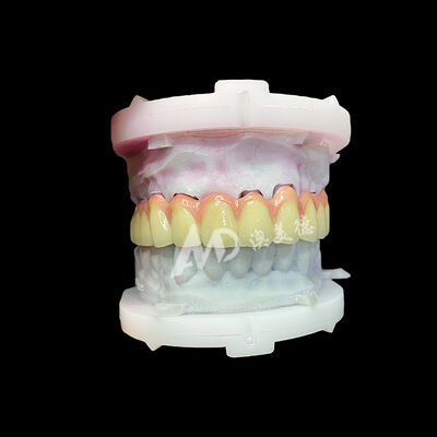 ভালো দাম বিশুদ্ধ টাইটানিয়াম সিরামিক ক্রাউন এবং ব্রিজ টেকসই হালকা ওজনের নান্দনিক পুনরুদ্ধার অনলাইন